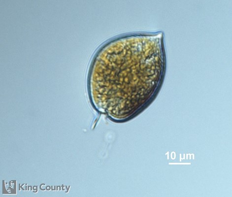 Photo of Prorocentrum micans